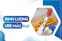 Định lượng ure máu bao nhiêu là cao?