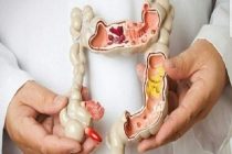 Căn bệnh táo bón: Nhiều nguyên nhân và khó điều trị